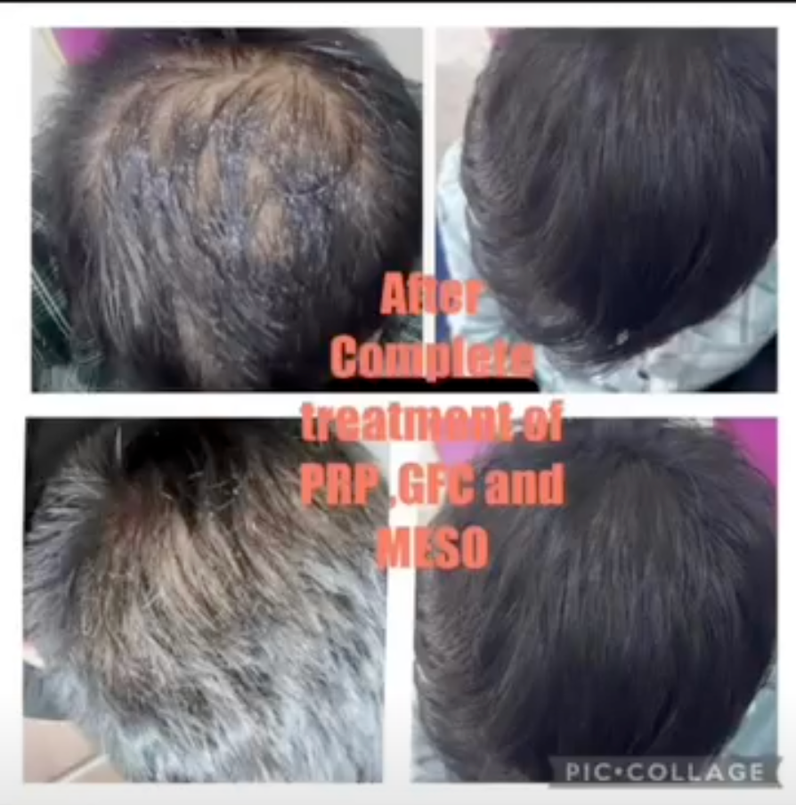 Skin before clinical treatment