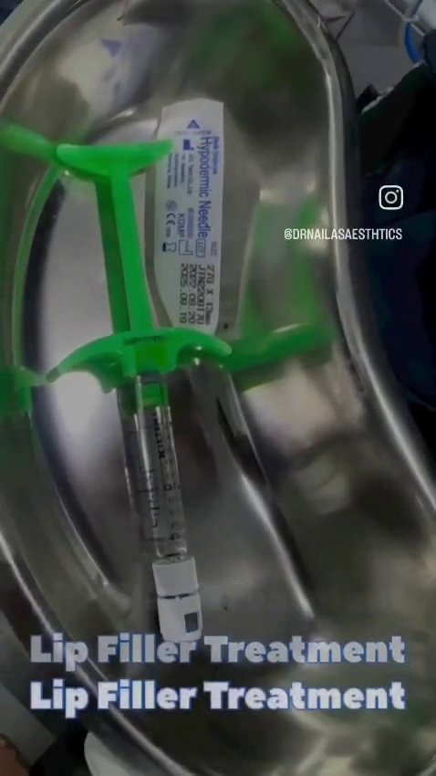 Lip Filler
