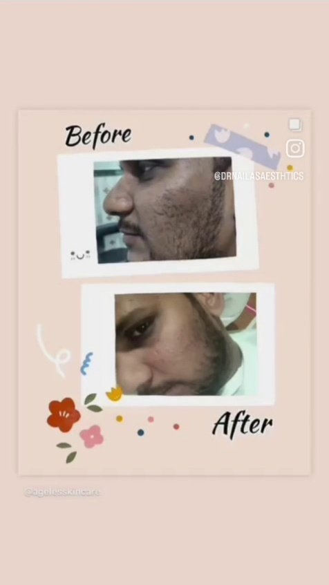 Advanced Laser & Tone Uniformity Transformation