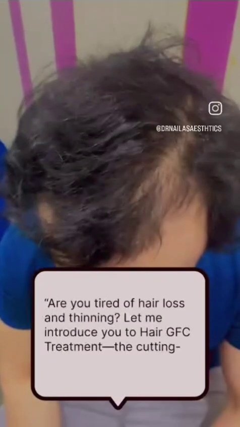 Hair Growth & Scalp GFC Procedure